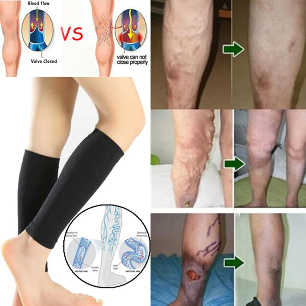 1Pc Unisex Protect Leg Calf Support Stretch Legs Support Open Toe knee Compression Soft Comfortable Socks for Outdoor Sports