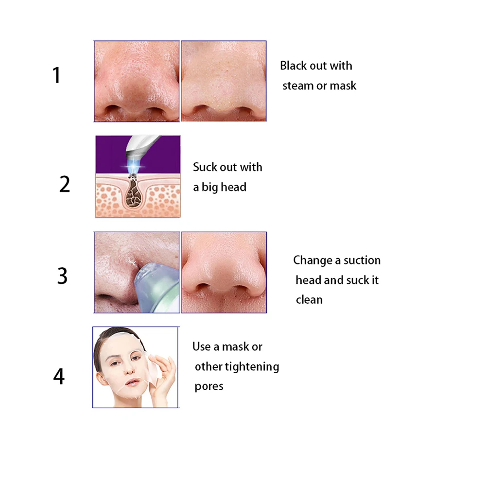 Электрический инструмент для удаления акне точка Noir Blackhead вакуумный экстрактор