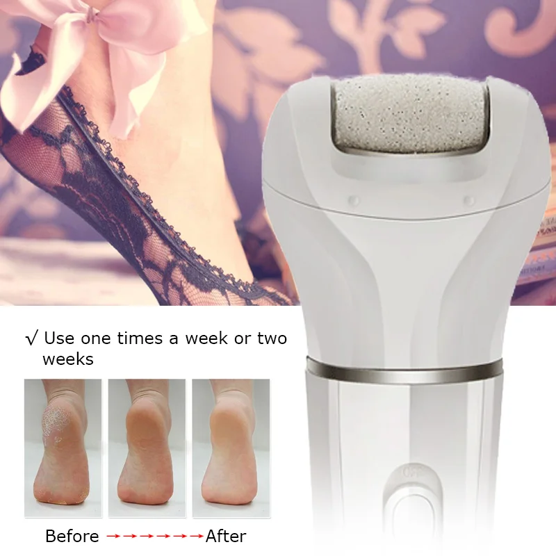 Rechargeable Electric Full Body Hair Removal Depilator Women