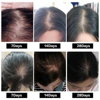 Hair Care 