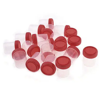 20 штук красный прозрачный Пластик круглый Форма мочи Тесты чашки держатель 60 мл w крышка