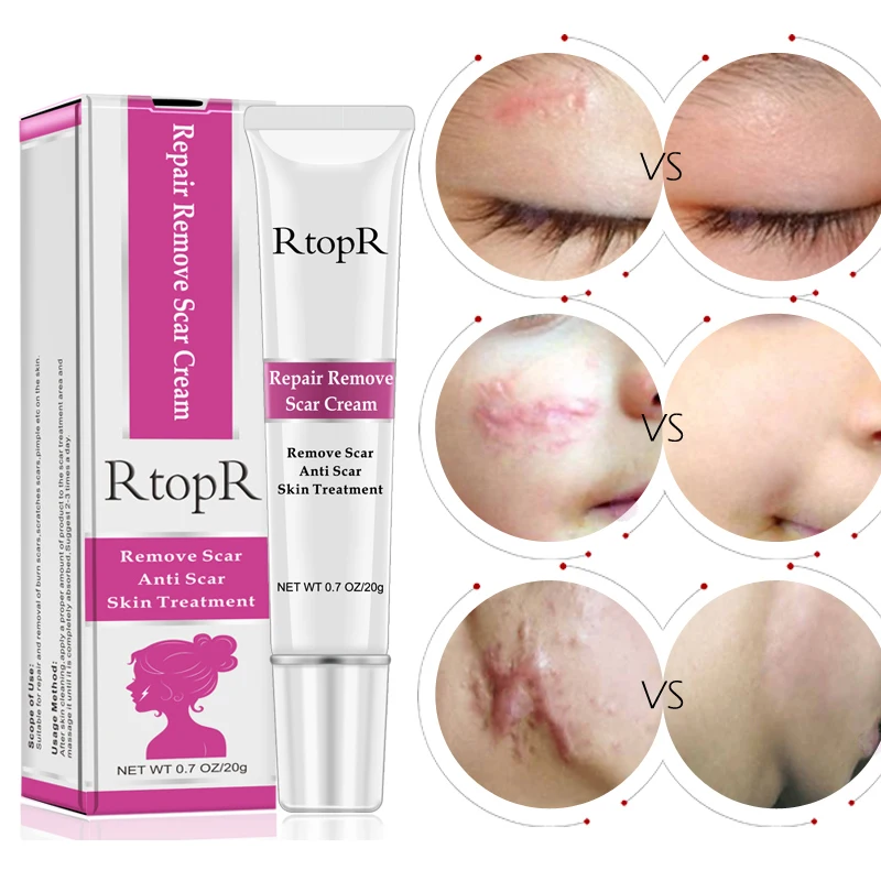 

1Pc 20g Skin Repair Face Cream Acne Scar Stretch Mark Removal Cream Health Body Skin Whitening Pigmentation Corrector Cream
