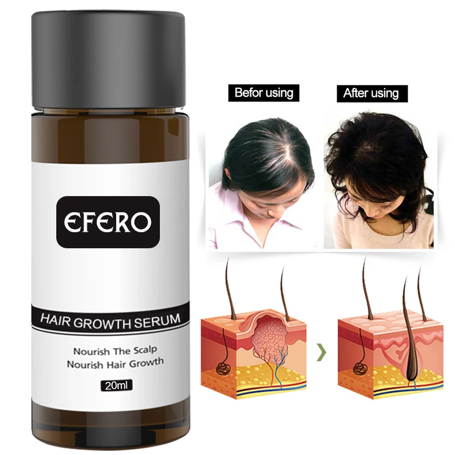 Hair Growth Essence Hair Loss Dense Hair Fast Hair Growth Grow Restoration Growing Serum Essential Oil