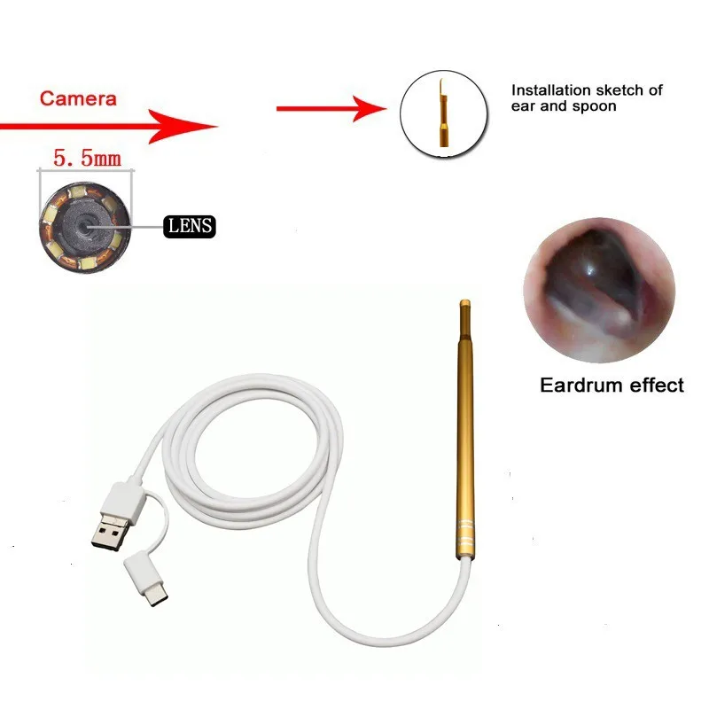 Ear Endoscope 4