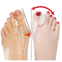 1 пара подушечек вальгусной деформации Broadhurst, ремедицинский силикагель для костного большого пальца, для ежедневного использования, силиконовые наборы для ухода за ногами, защита для пальцев ног