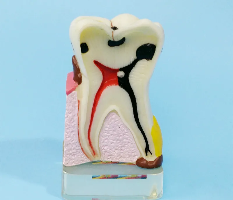 4X увеличить человеческие зубы модель человеческих зубов анатомическая модель зубы патологии манекен для медицинского обучения помогает