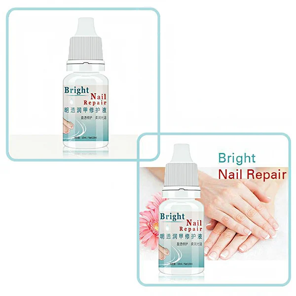 

2Pcs Anti Fungal Treatment Extra Strength Toenail Fungus Athletes Foot Fungi Nail Cream 669