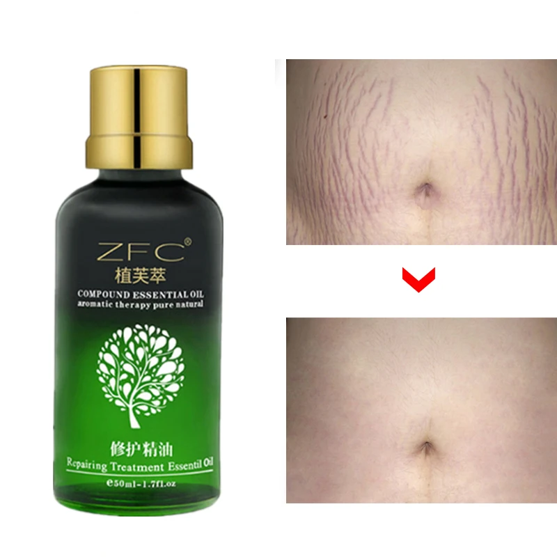 

Remove Stretch Marks Cream Anti Wrinkle Anti Aging Maternity Skin Repair Remove Pregnancy Scars Treatment Body 50ml