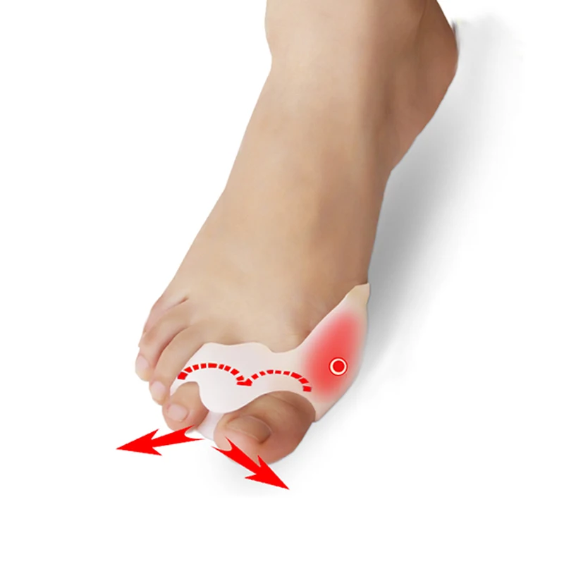

4 Pieces=2 Pairs Hallux Valgus Braces Toes Correction Broadhurst Pad Sub-toe Toe Separator Remedical Daily Foot Care