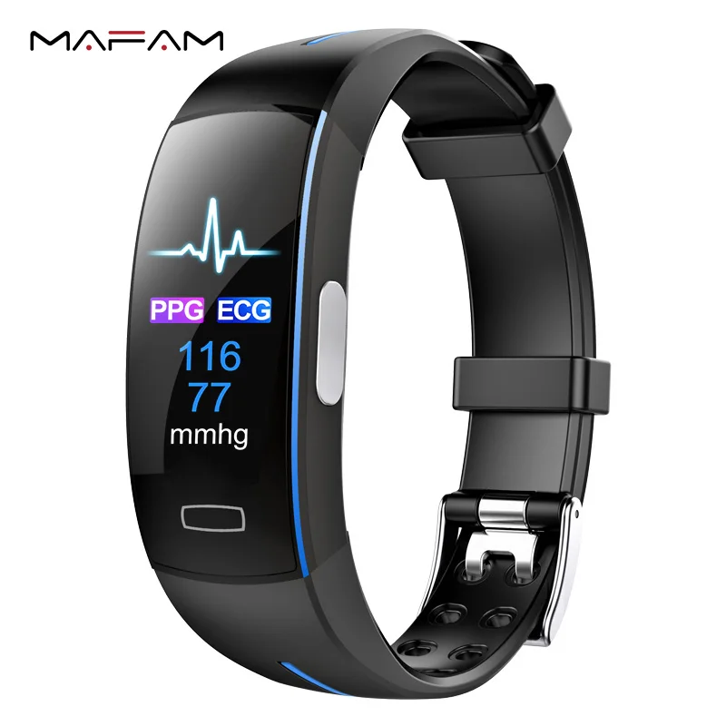 iphone watch with ekg