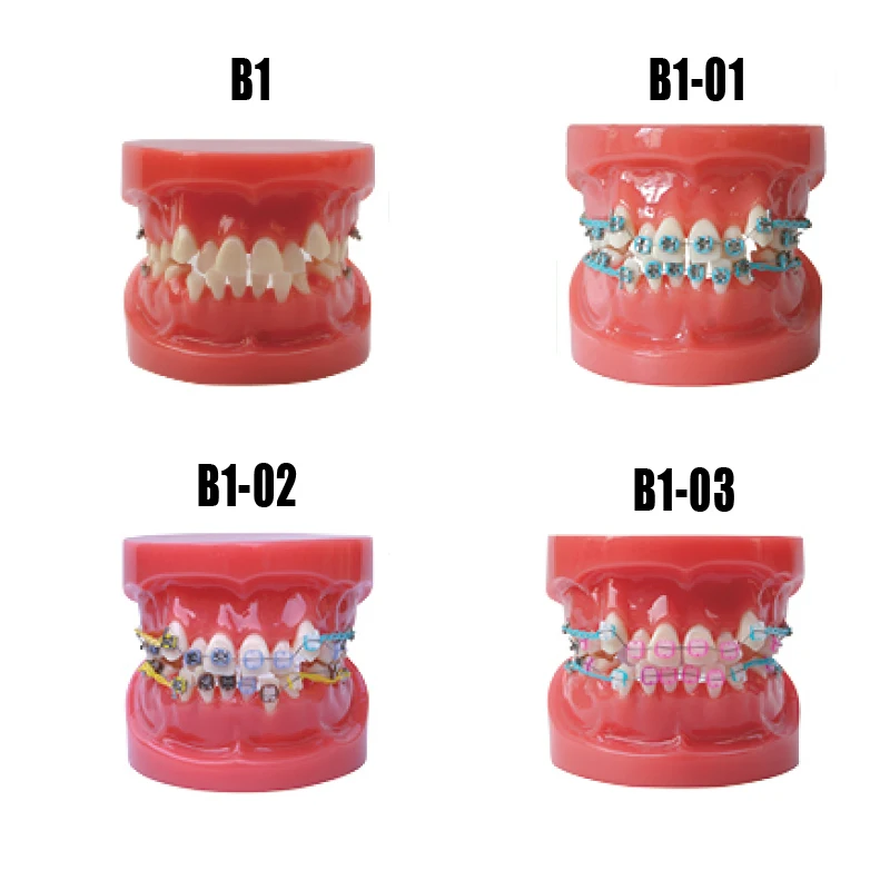 Стоматологическое исследование зубов Модель Ортодонтическая модель с металлом и керамический кронштейн