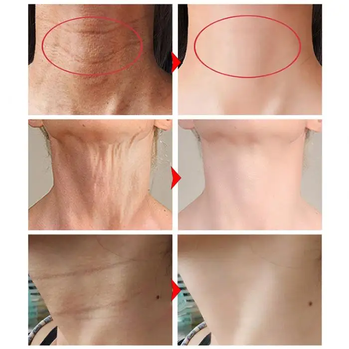 Экстракт масла ши увлажняющий шеи питательный крем увлажняющий разглаживание тонких линий средства ухода за кожей Шеи FM88