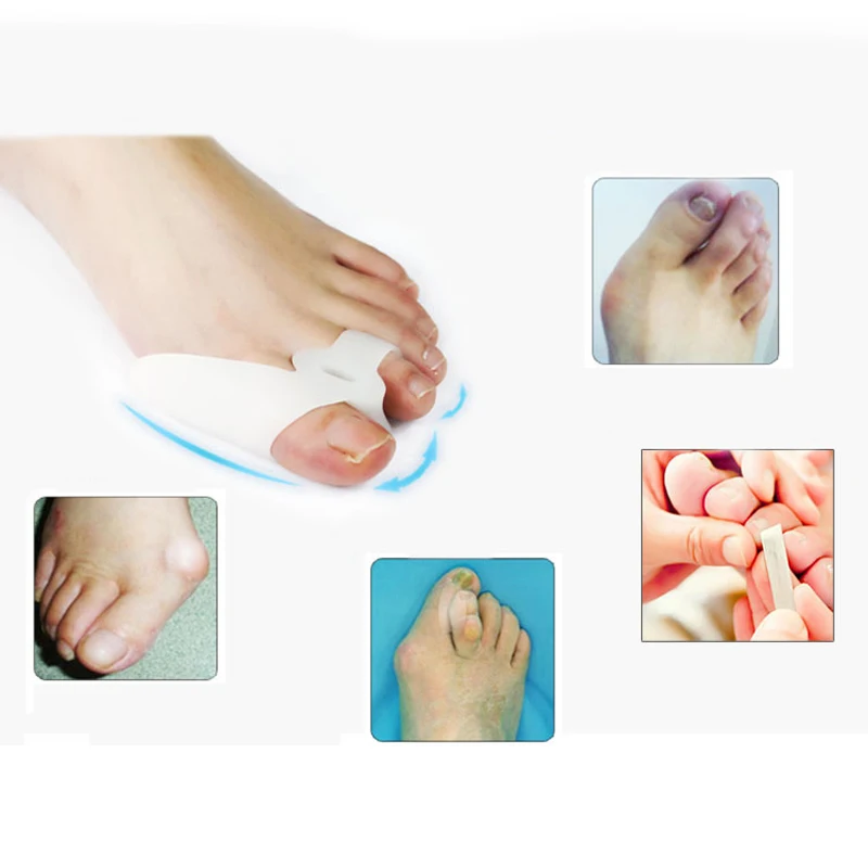 2Pair Foot Bones Silicone Toes Separator Bunion Corrector Big Toe Foot Care Pain Foot Hallux valgus Orthotics Corrective Insole