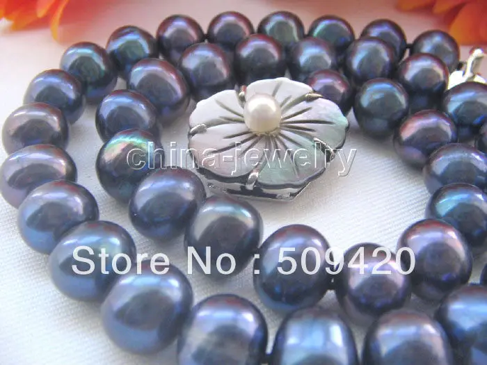 

Free Shipping > Beautiful 17.5" 10-11mm peacock blue FW pearl necklace - shell clasp