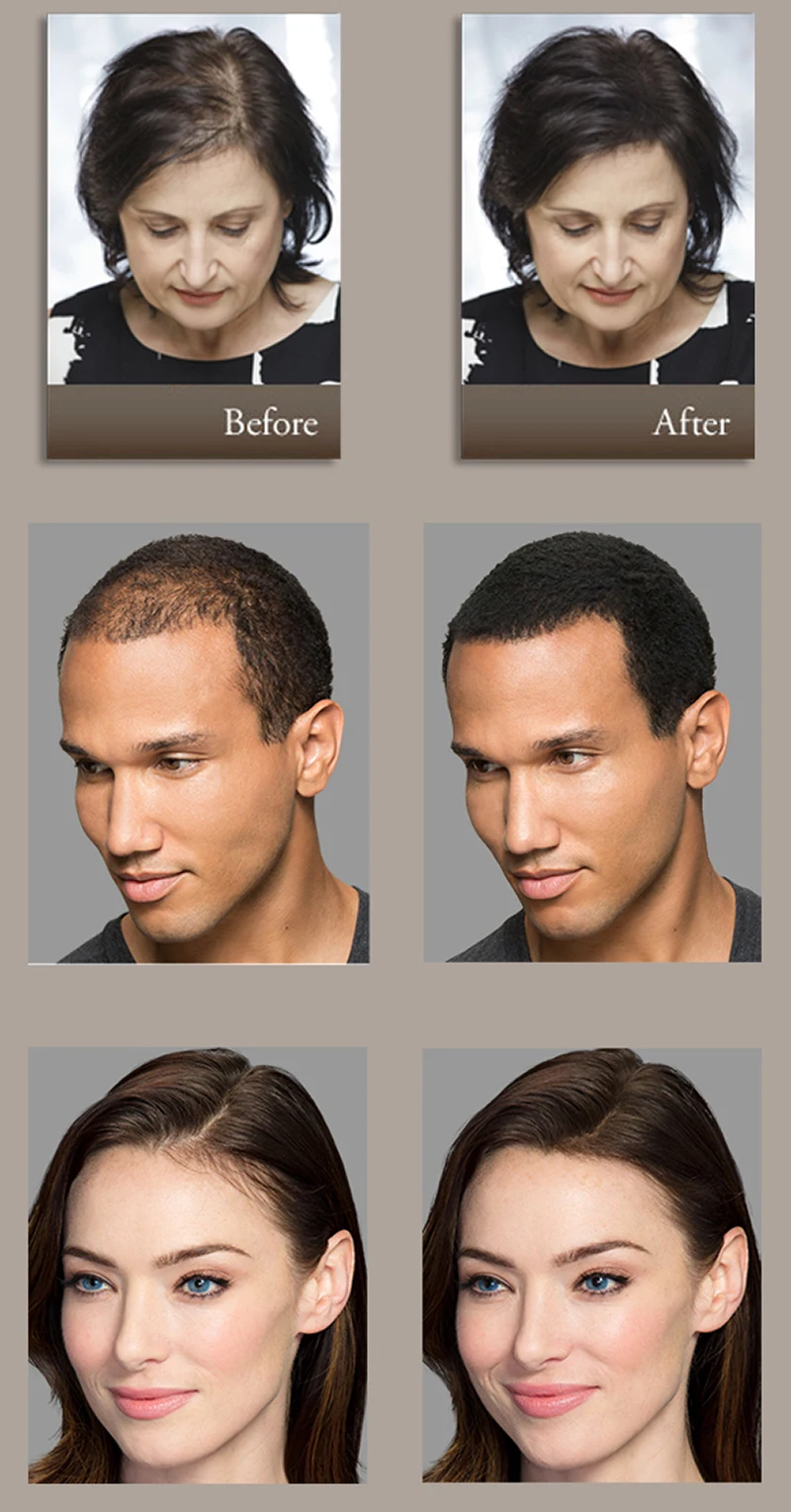 Vermelhos do Reenchimento do Tratamento da Perda de Cabelo Usada para a Garrafa das Fibras do Cabelo a Construção das Fibras do Cabelo dos Bolsas 5 Prod. perda cab. masc.