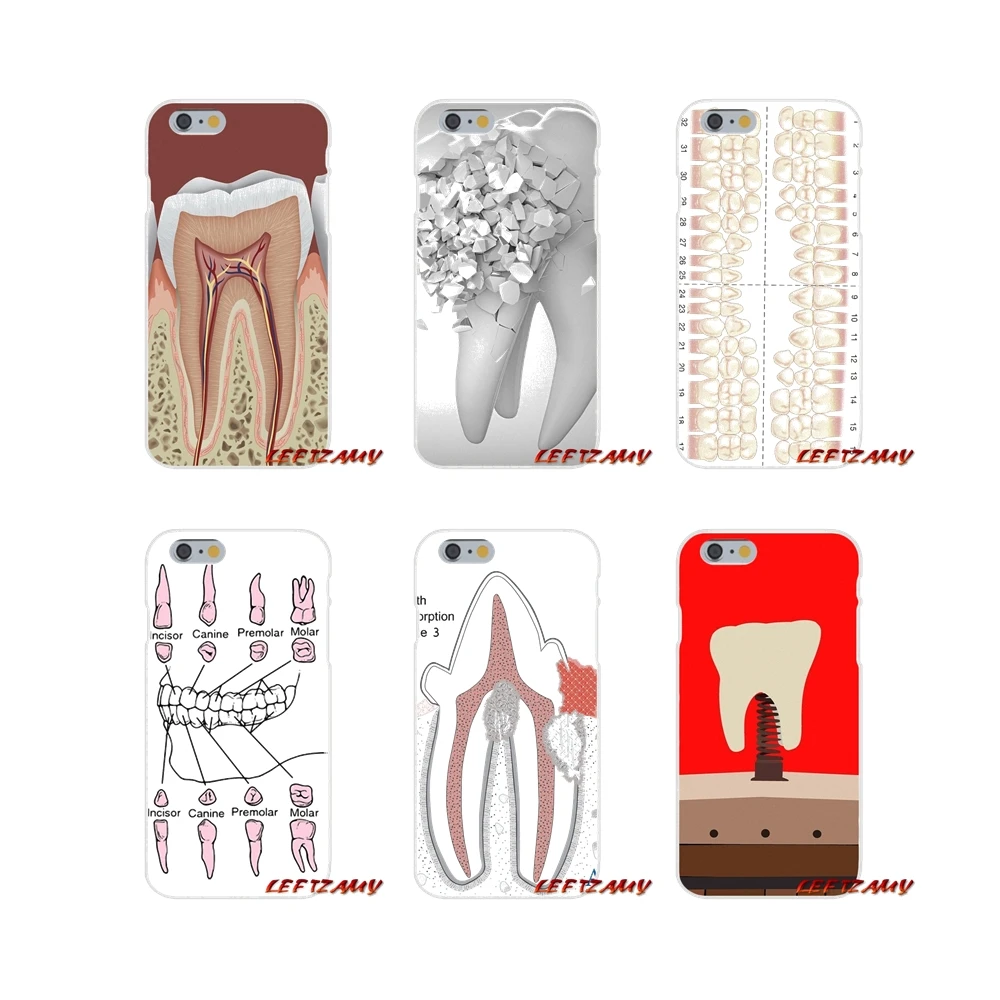 Чехлы для определения зубов для iPhone X, XR, XS, MAX, 4, 4S, 5, 5S, 5C, SE, 6, 6 S, 7, 8 Plus, ipod touch, 5, 6, аксессуары