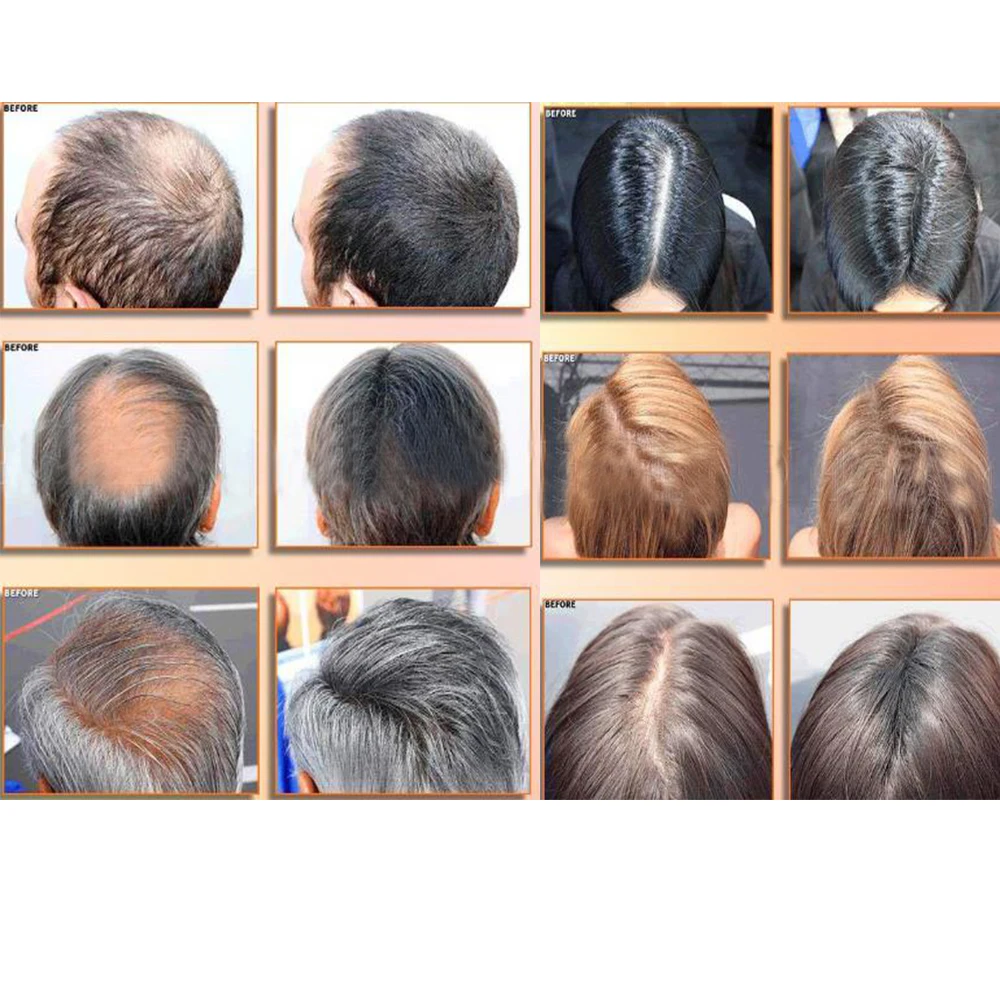 Профессиональный Шампунь BOQIAN 300 мл против выпадения волос с имбирем|anti hair loss
