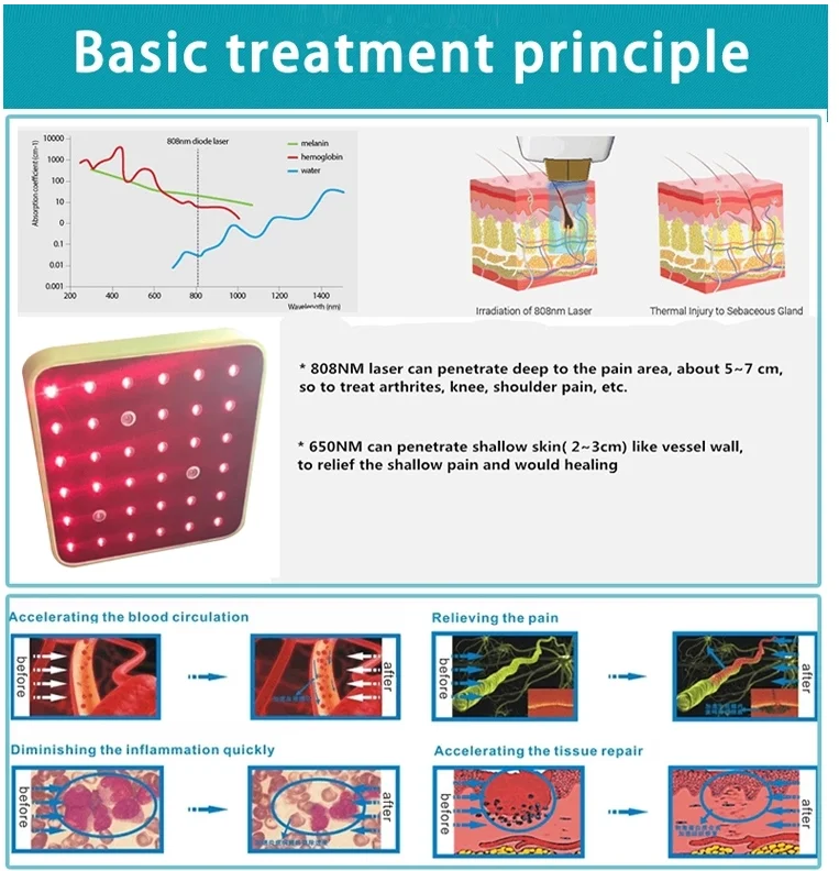 Персональный полупроводниковый 808 низкоинтенсивный лазер колено и локоть массажер лазер для облегчение боли в колене и ран лечебное