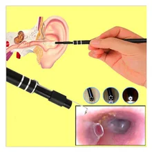 

Multi-Function USB Ear Cleaning Endoscope Tool 5.5mm Visual Ear Spoon Endoscope Camera Mini Camera Pen Ear Care Endoscope