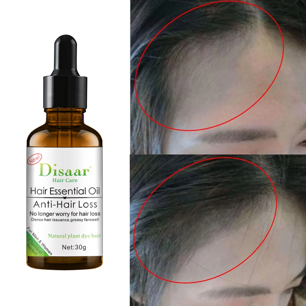 Hair Growth Development Essence Anti-hair loss Hair Care Deep Nourishment Hair Conditioner Essential oil 30ml