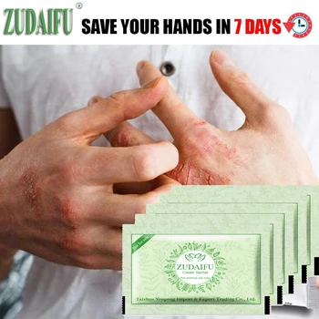 

10Pcs/Lot zudaifu Body Psoriasis Ceam China Creams Psoriasis Ointment Massage Body Cream