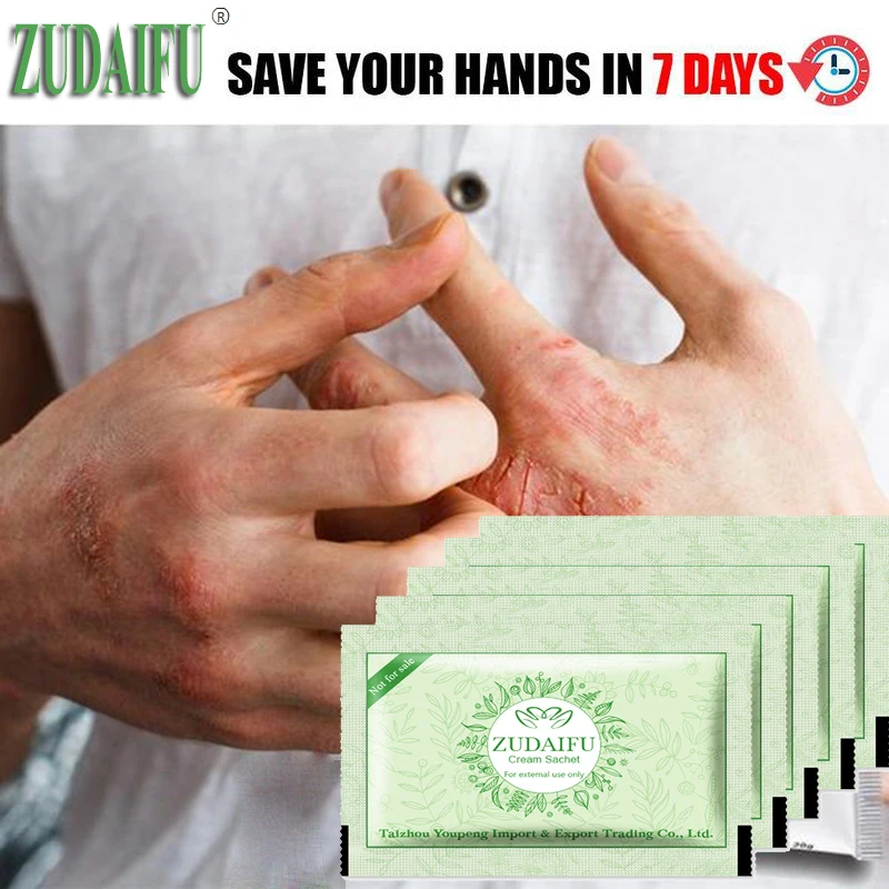 

5Pcs/Lot zudaifu Body Psoriasis Ceam China Creams Psoriasis Ointment Massage Cream
