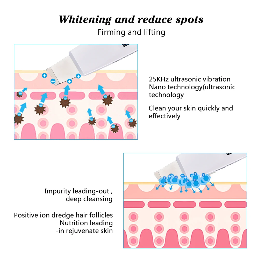 Ultrasonic Skin Scrubber Spatula Blackhead Removal Pore Cleanser Deep Face Cleaning Skin Peeling Machine Spa Beauty 4