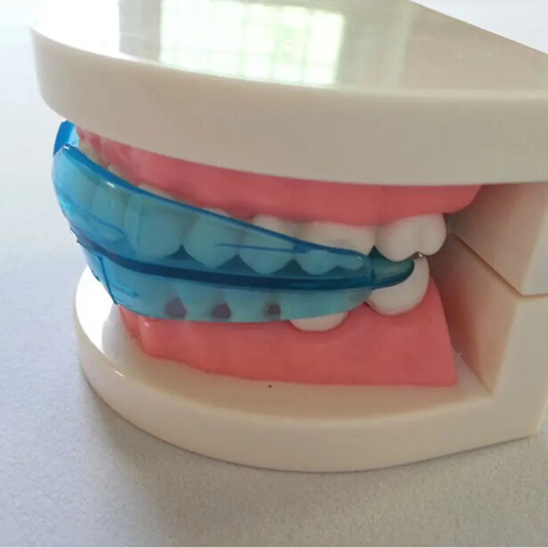 

Orthodontists Invisible Corrective Braces Upgraded Orthodontic Brackets MH88