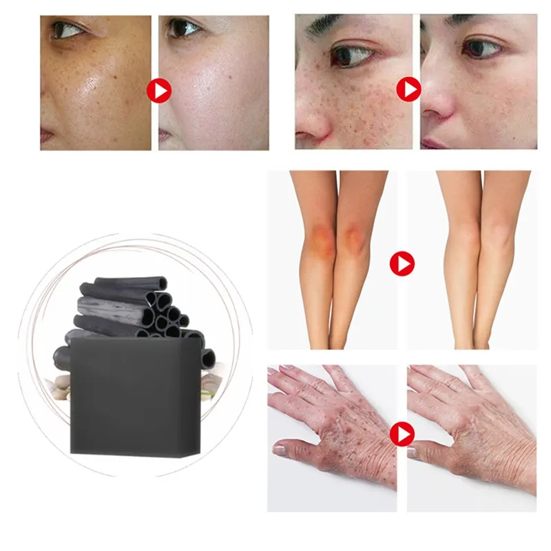 

1Pcs Acne Scar Remover Cells Regeneration Skin Repair Face Soap Acne Spots Acne Treatment Oil Control Blackhead Whitening Soaps