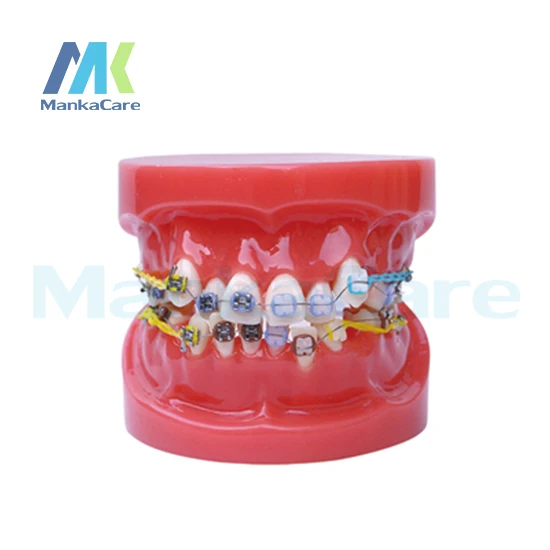 manka-care-24pcs-tooth-half-metal-half-ceramic-bracket-oral-model-teeth-tooth-model