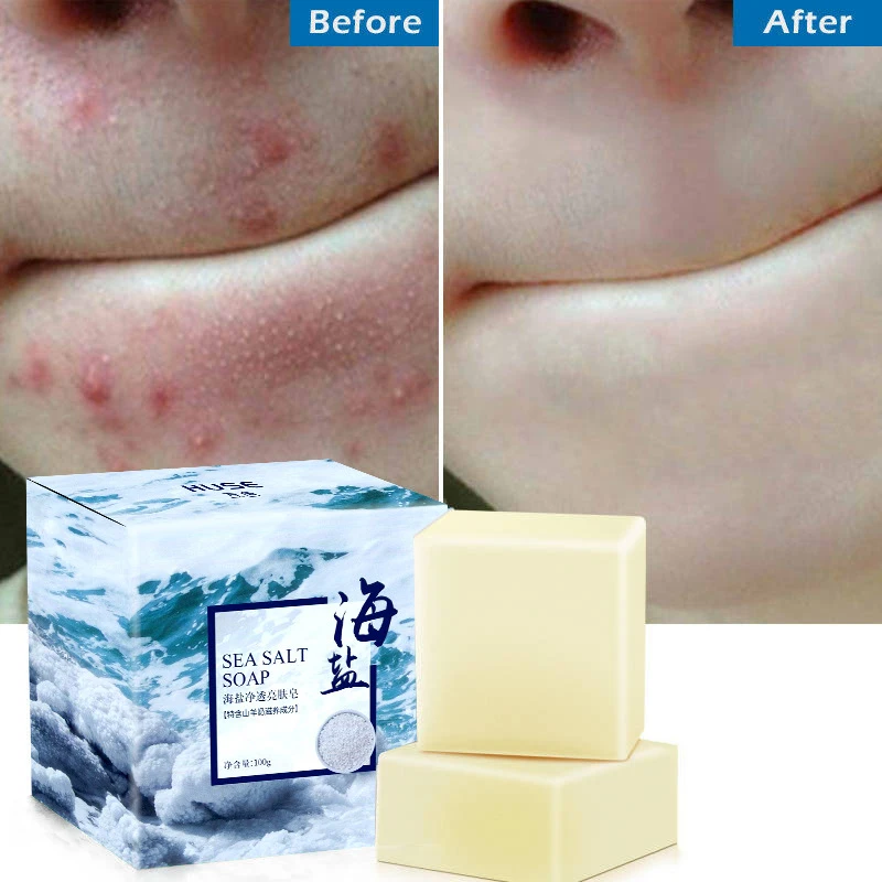 Sea Salt Soap Pimple Acne Treatment Goat Milk Moisturizing Face Cleaning Soap YUF99