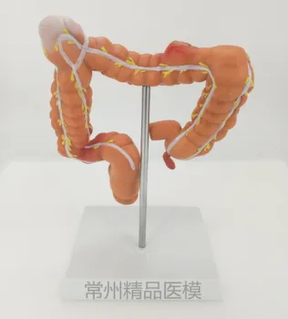 

Colon pathological model Colorectal lesions specimens Intestinal anatomy model