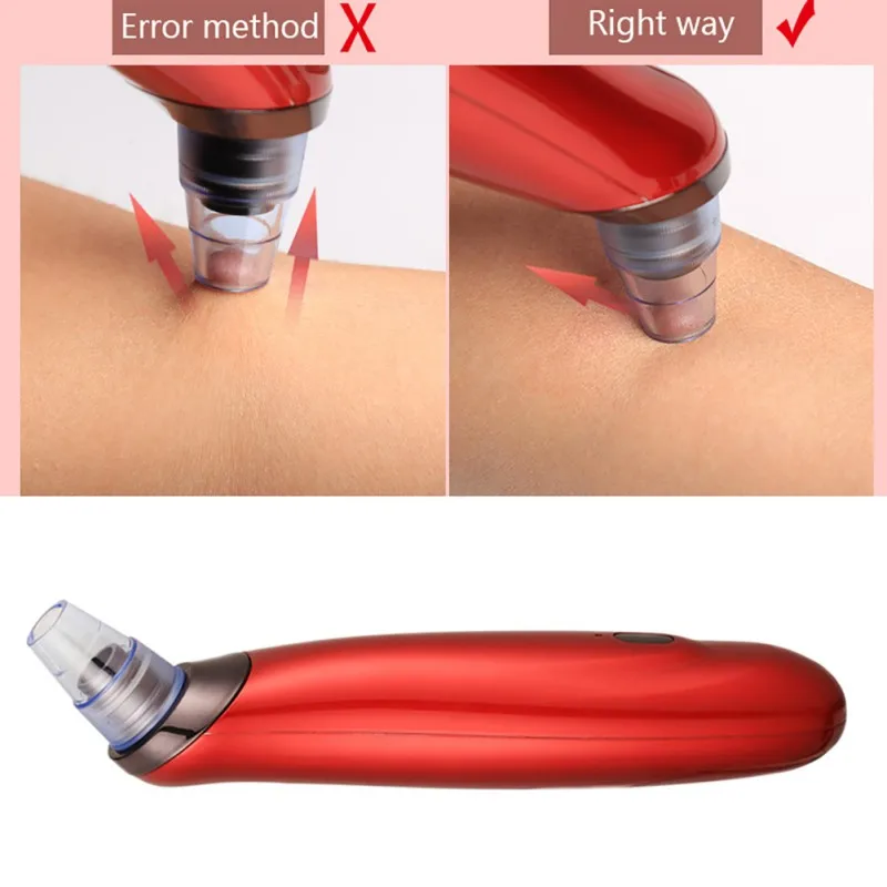 Электрическая машинка для удаления угрей инструмент вакуумное средство для устранения черных точек инструмент beauty Face 3 цвета
