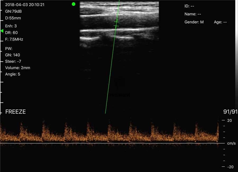IMG_6374
