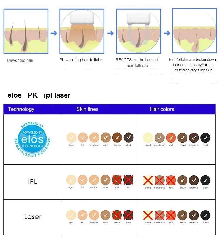 elos hair removal  13