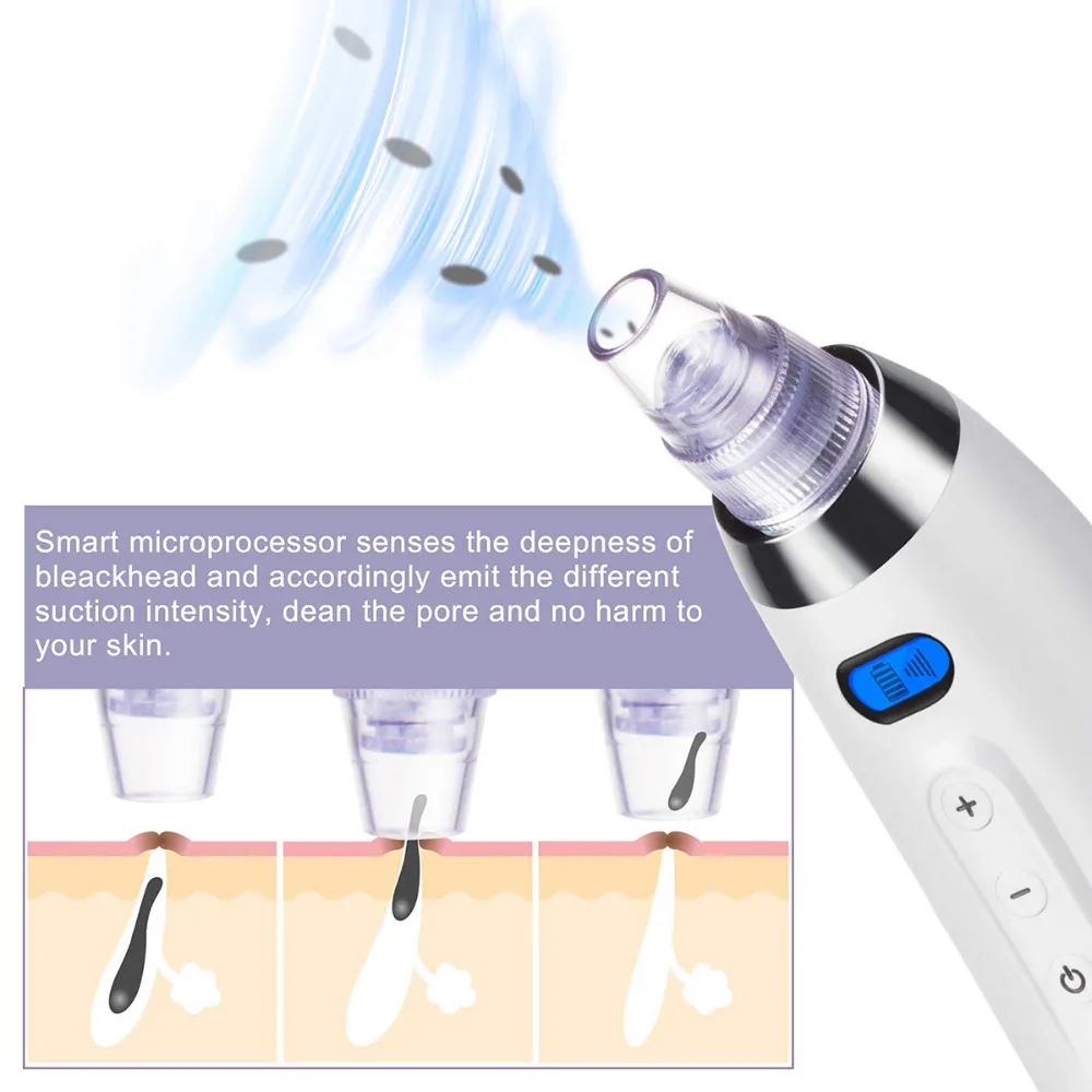 Настоящий электрический пылесос для удаления угрей, очиститель пор, очищающее средство от акне, косметическая машина для чистки лица, инструменты для ухода за кожей лица