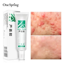 OneSpring Aloe vera gel face cream Anti Acne Anti-sensitive Oil-control Repair after-sun moisturizer relieving itching skin care OneSpring Aloe vera gel face cream Anti Acne Anti-sensitive Oil-control Repair after-sun moisturizer relieving itching skin care