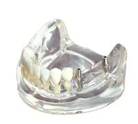 dental model 27