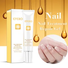 Лечение ногтей от грибка Уход за ногами отбеливающая эссенция ног удаление грибка гель анти-инфекция Onychomycosis ногтей восстанавливающая эссенция