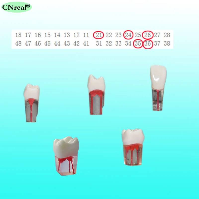 5 шт./компл. ендодонтик практика модель зубов для RCT прозрачный смолы с окрашенная корневого канала