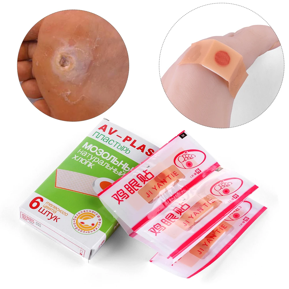 

1Set New Foot Corn Removal Plaster Warts Thorn Remove Corn Foot Patch Anti-germ CallusesPad Patch Plantar Killer Feet Tretment