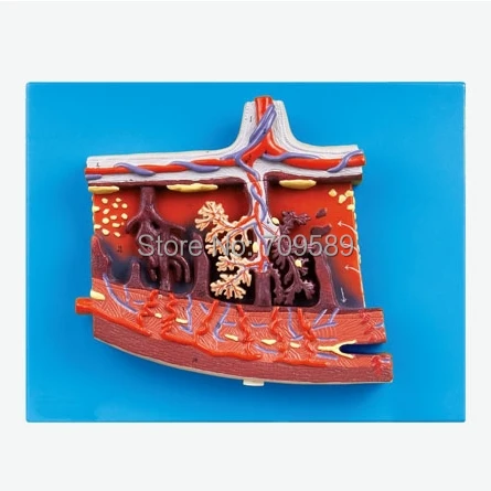 ISO Enlarged Anatomical model of placenta and placenta tissue