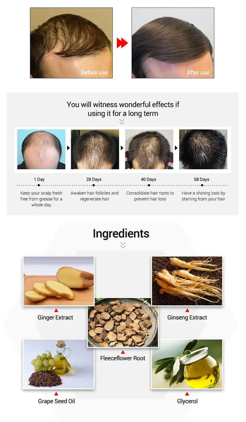 20 мл лечение волос быстрое мощное средство для роста волос продукты Эфирное Масло жидкое лечение предупреждающий потерю волос уход за волосами