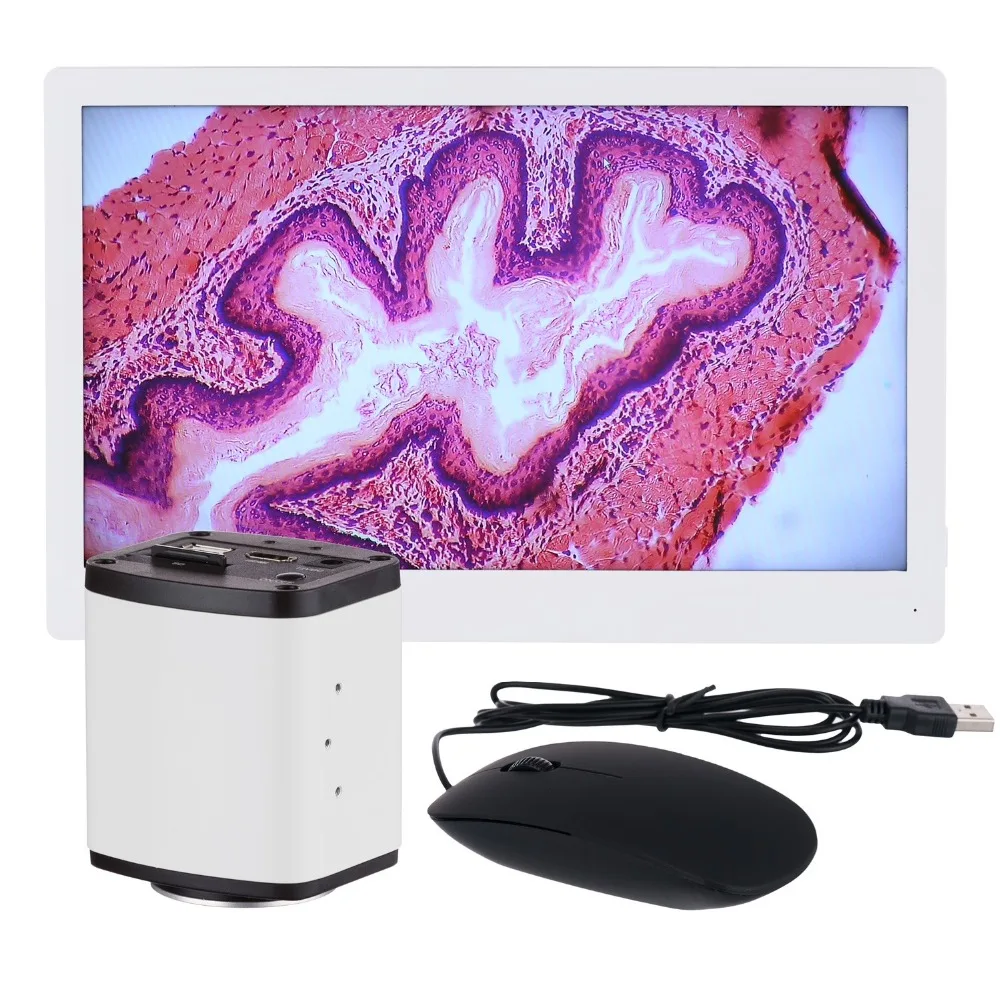 

AmScope 1080p HDMI Microscope C-mount Camera + HD Monitor HD1080A-HDM