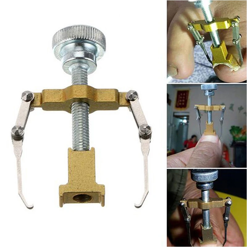 

Nail Aligner Ingrown Toe Gold Silver Color Metal Pedicure Toenail Fixer Foot Recover Clipper Correction Nail Care Tools