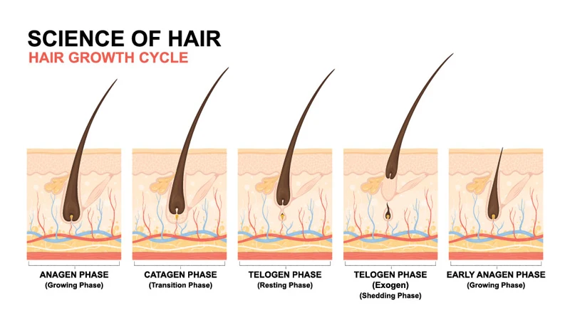 Fortalecer o Cabelo Unissex Calvície Anti Queda Cabelo Crescimento Soro Spray Shampoo Alopecia Tratamento 4 Unissex calvície anti queda cabelo crescimento soro