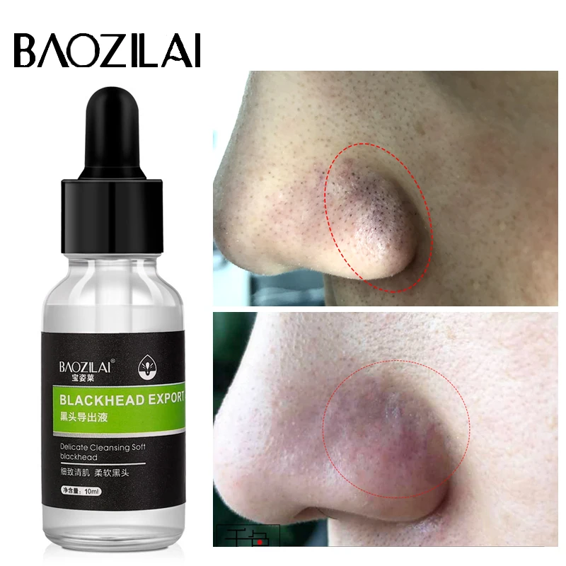 

BAOZILAI 100% Plant Aloe Vera Hyaluronic Acid Face Serum Deep Cleansing Remover Nose Blackhead Acne Treatment Skin Care Beauty