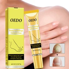 Женьшень травяное удаление ногтей грибок пальцев ног ногтей противогрибковое лечение крем против инфекции Paronychia Onychomycosis Уход за ногами Крем