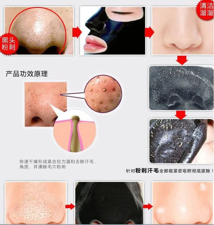 blackhead mask