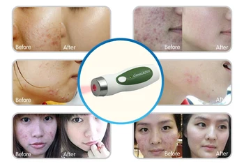 

Dual laser light therapy Device Scars Acne Remover Facial Beauty Skin Care no pain no side effect